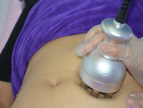 Tighten saggy skin with radio frequency treatment