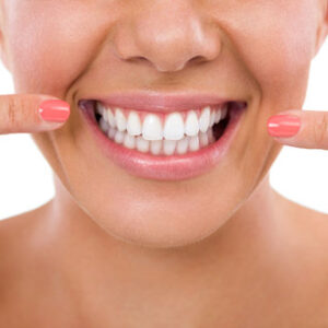 Teeth Whitening