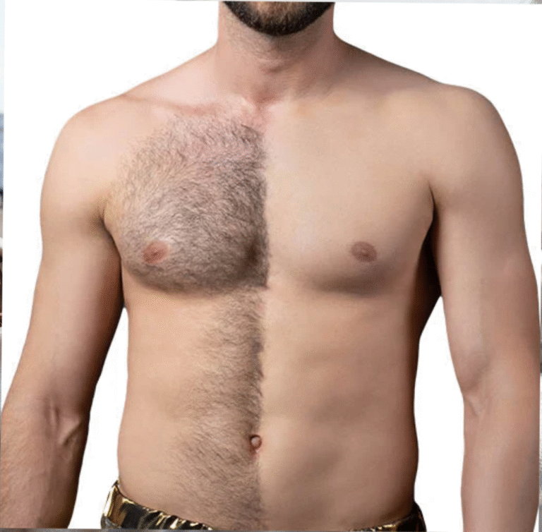 Laser hair removal for large area at iOnyx Medspa Merritt Island – smooth skin, permanent reduction