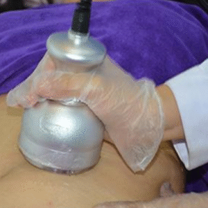 Cavitation body sculpting treatment for fat loss and post-surgery recovery at iOnyx Medspa Merritt Island