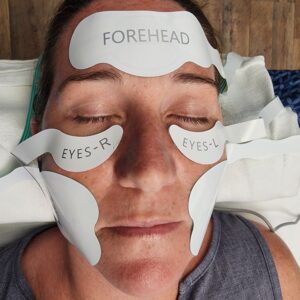 SculptTRIO Full-Face Contour Treatment - Non-Surgical Facial Lift - iOnyx Medspa Merritt Island