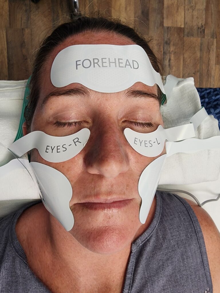 SculptTRIO Full-Face Contour Treatment - Non-Surgical Facial Lift - iOnyx Medspa Merritt Island