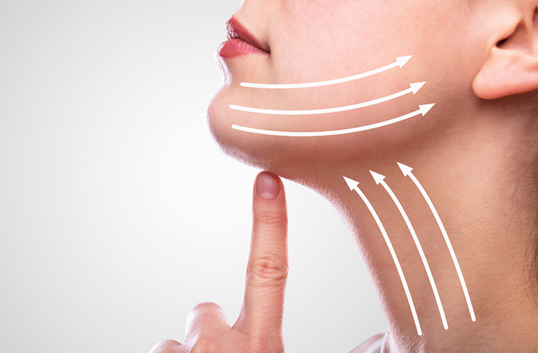 SculptTRIO Chin Contouring Treatment - Non-Surgical Fat Reduction & Lift - iOnyx Medspa Merritt Island