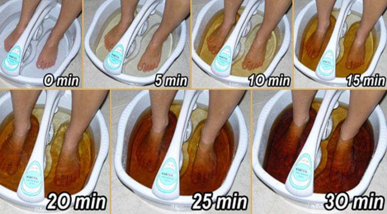 Ionyx Foot Detox